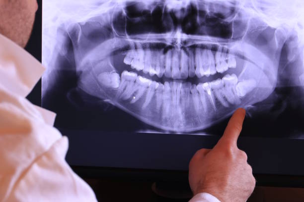 Best Emergency Root Canal Therapy in New London, WI